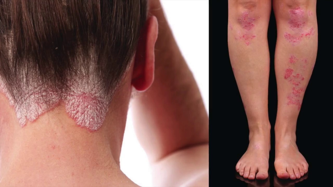 10 Best Red Light Therapy DeviceRed light Therapy Machine Reviews