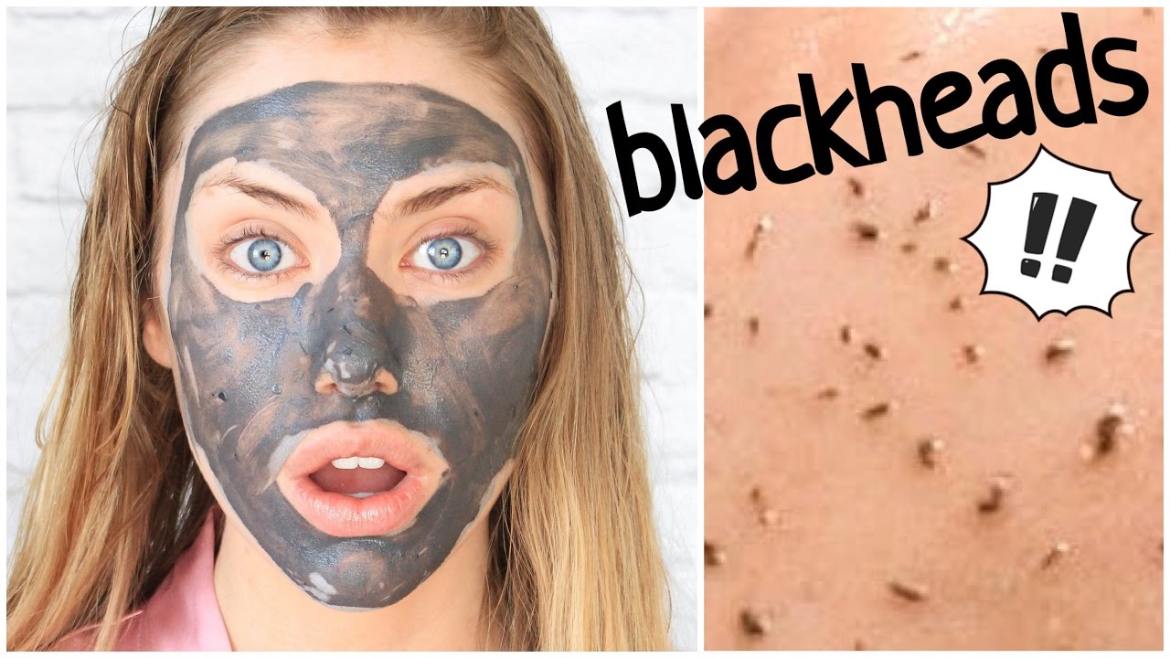 The 17 Best Blackhead Remover Products On The Market