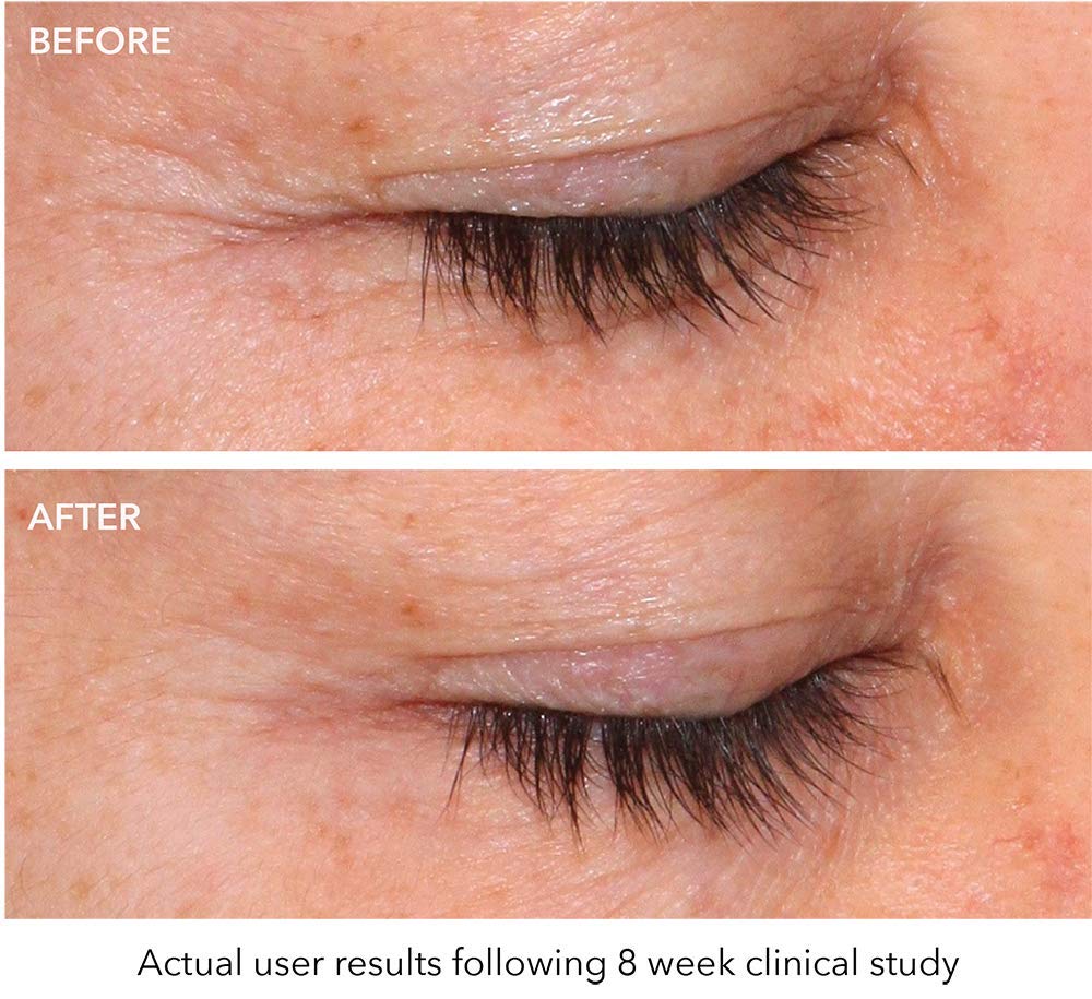 Baby Quasar MD Plus AntiAging Red Light Therapy Reviews Cosmetic News