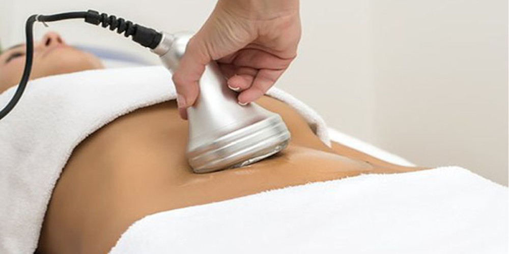 Radiofrequency Cavitation 